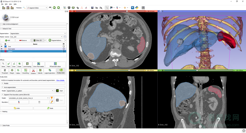 免费开源的医学图像处理和可视化分析软件-第1张-吾帮找网